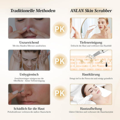 Pulizia Viso Ultrasuoni, ANLAN Skin Scrubber Professionale Per Pulizia Profonda la Viso Peeling e Cura,4 Modalità Rimozione di Comedone Punti Neri Rimozione, USB Ricaricabile
